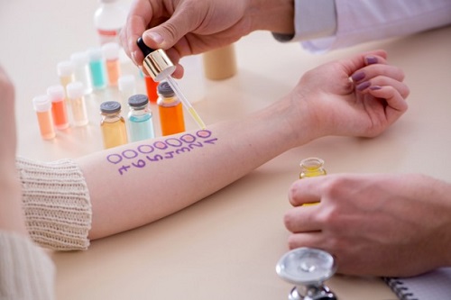 alergia, procedimientos alergia, procedimientos