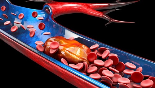 enfermedades que trata la hematologa